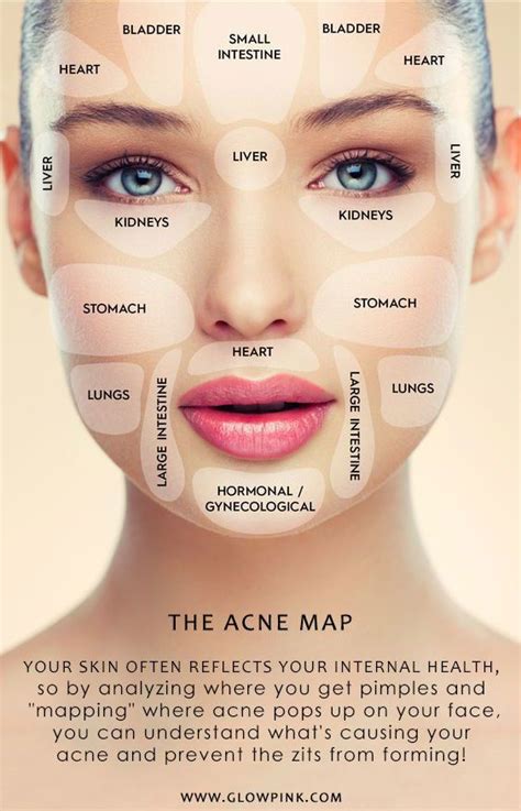 Acne Face Map And Solutions Shearlingwomenbestquality