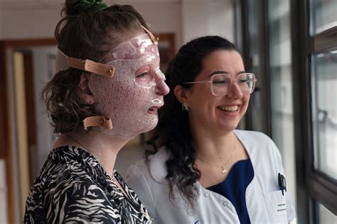 Treating Children With Severe Burns Using Face Masks Produced With 3d