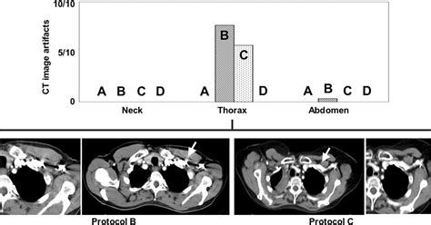 Optimized Intravenous Contrast Administration For Diagnostic Whole Body