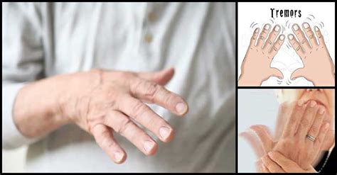 Tremor Hand Hand Tremors Causes Of Hand Tremors A Tremor Is An