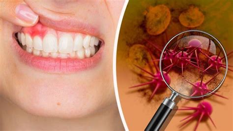 Heres How To Know If You Have Inflammation In Your Mouth