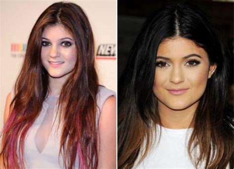 This is kylie jenner's plastic surgery timeline. Kylie Jenner Before and After Photos (2008 to 2019)