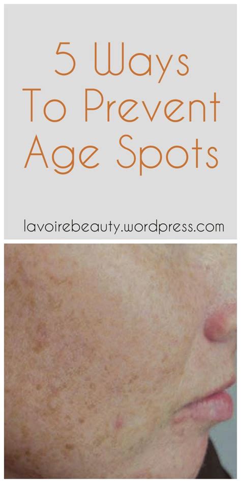 5 Ways To Prevent Age Spots Prevent Aging Age Spots Natural Skin Care