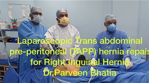 Laparoscopic Trans Abdominal Pre Peritoneal Tapp Hernia Right