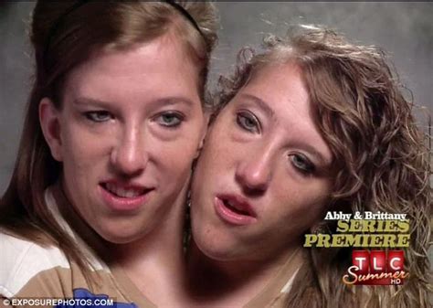Conjoined Twins Abigail And Brittany Hensel Offer A Glimpse In To Their