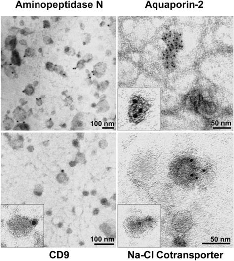 Immunoelectron Microscopy Of Urinary Vesicles Immunogold Labeling