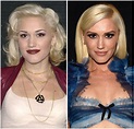 What Did Gwen Stefani Look Like Before Plastic Surgery? See Pics!