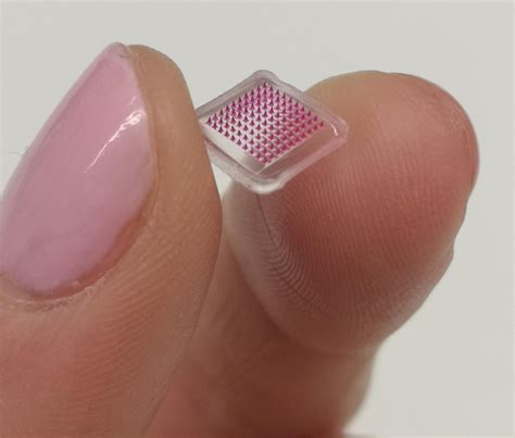 Microneedle Patch Image Eurekalert Science News Releases