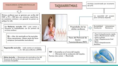 Taquicardia Supraclavicular En El Anciano Middlemedic Udocz