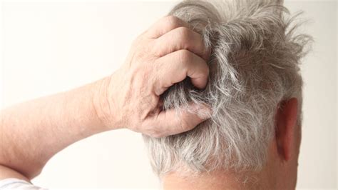 Scalp Scabs Causes And How To Treat Them