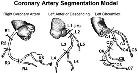 Aligning Coronary Anatomy And Myocardial Perfusion Territories