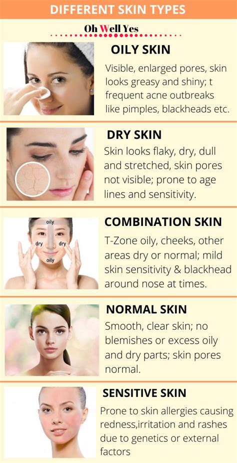 How To Know Your Skin Type To Care Better Oh Well Yes Dry Skin On Face Skin Care Routine