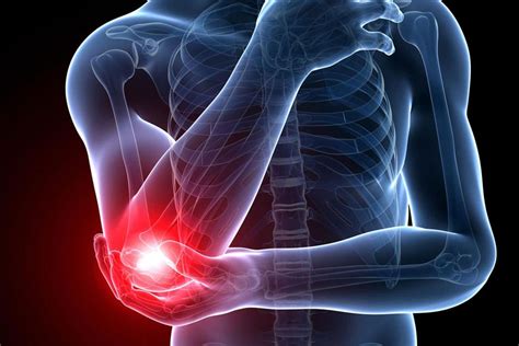 Elbow Pain Singleton Physiotherapy