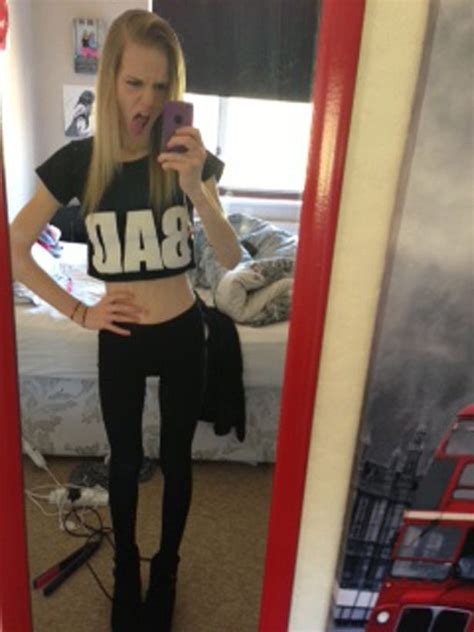 Thinspiration Selfies Almost Killed Me Anorexia Survivors Warning