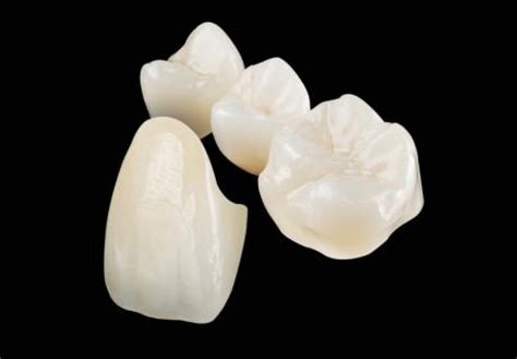Pourquoi choisir les couronnes dentaires en céramique zircone