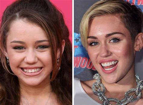 celebrity teeth six best dental before and after makeovers