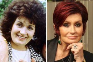 Cher plastic surgery lists includes rhinoplasty, botox. sharon osbourne before and after plastic surgery | Plastic ...