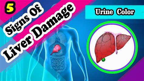 Liver Issues Symptoms Bfsilope