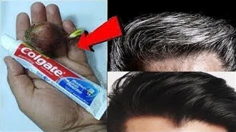 Permanently Get Rid Of Gray Hair From The First Use Permanently