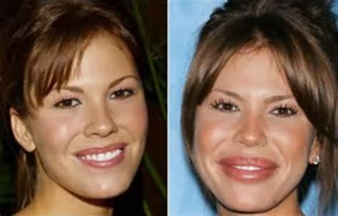 Celebrity Before And After Plastic Surgery Disasters Reading A Word