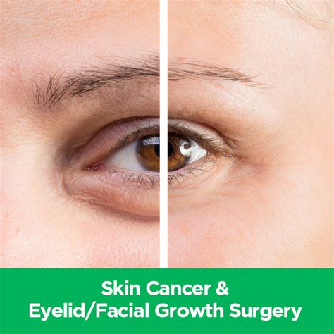 Oculofacial Plastic Surgery And Aesthetics Center For Advanced Eye Care