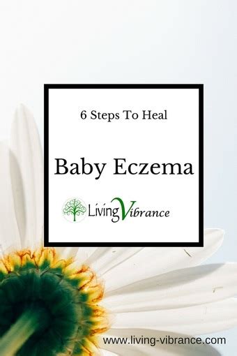 6 Steps To Heal Baby Eczema For Good Living Vibrance
