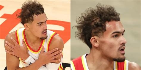 Look At Trae Youngs Bizarre Hair Is He Balding Hair System