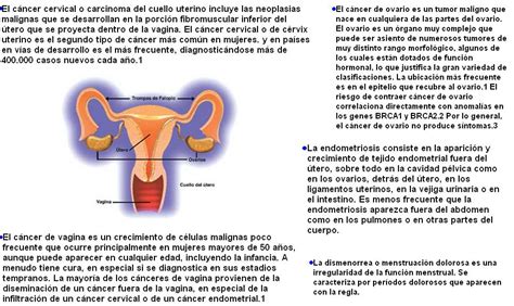 Chibiology Enfermedades Que Afectan El Aparato Reproductor Femenino My Xxx Hot Girl