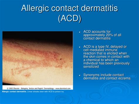 Ppt Contact Dermatitis Part One Powerpoint Presentation Free