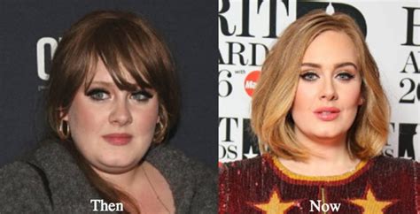 adele s before and after surgery photos show proof of the singer s transformation back beat funds