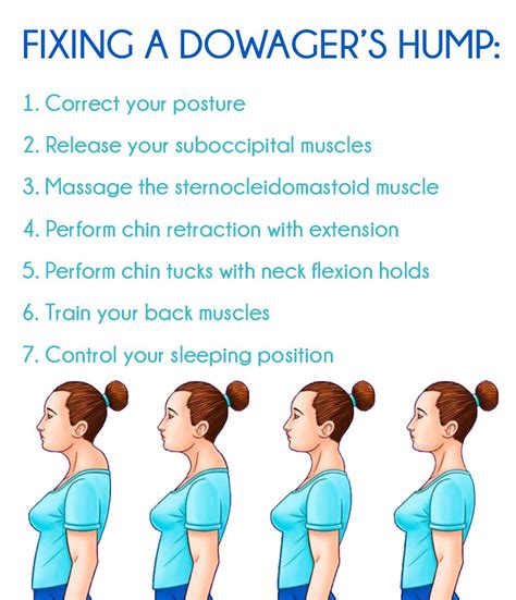 Dowagers Hump Fix Avoid A Dowagers Hump Granny Health Today Nacken Training Fitness