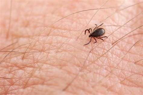 What To Do If Youre Bitten By A Tick Readers Digest