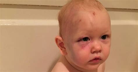 Babysitter Gets Away With Abusing Baby POPSUGAR Family