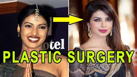 top 10 plastic surgery of popular tv actress before after photos