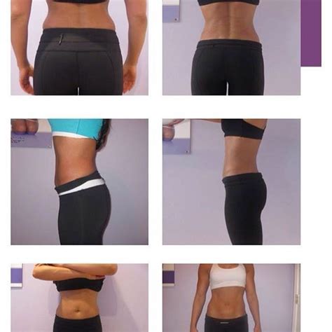 Here Are Some Examples Of Real Results From Lipo Light Clients 🙌 Great For Those Areas That Don