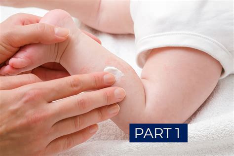 Common Baby Rashes And Skin Conditions And What You Can Do To Address