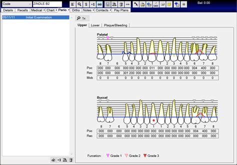 how to do perio charting