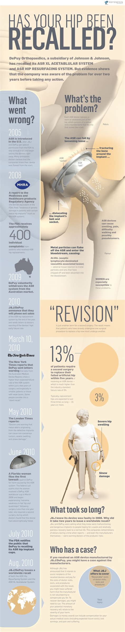 Hip Recall Class Action Lawsuit Hip Replacement Hips Infographic Health