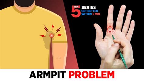Left Armpit Treatment By Sujok Armpit Infection😖🤚🏻 Allergy Sweating