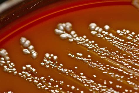 Enterococcus Faecalis Microbiology Lab Laboratory Science Microbiology