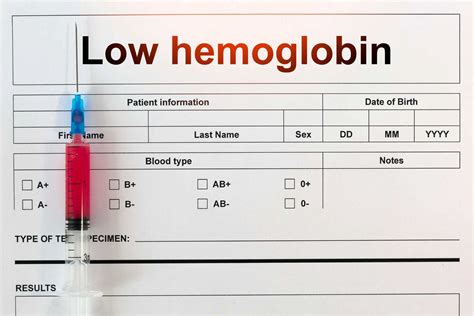 Causes Of Low Hemoglobin Symptoms And Treatment Wockhardt Hospitals