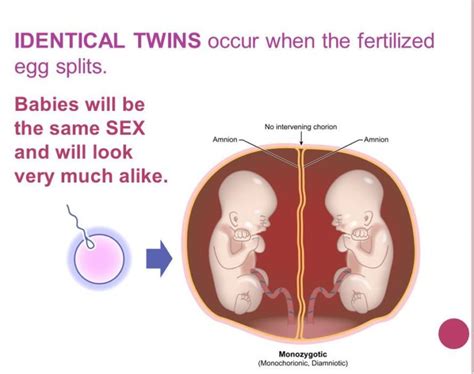 Twins Using Ivf Can They Be Produced When It Is Transferred Only One