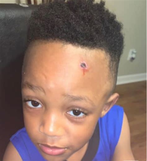 Fake Bullet Wound Painted On Second Grader Angers Mom