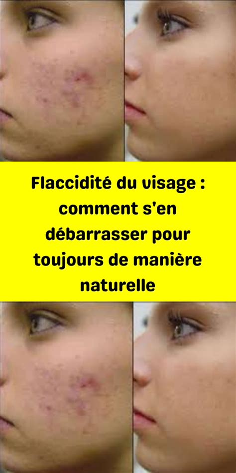 Flaccidité Du Visage Comment Sen Débarrasser Pour Toujours De