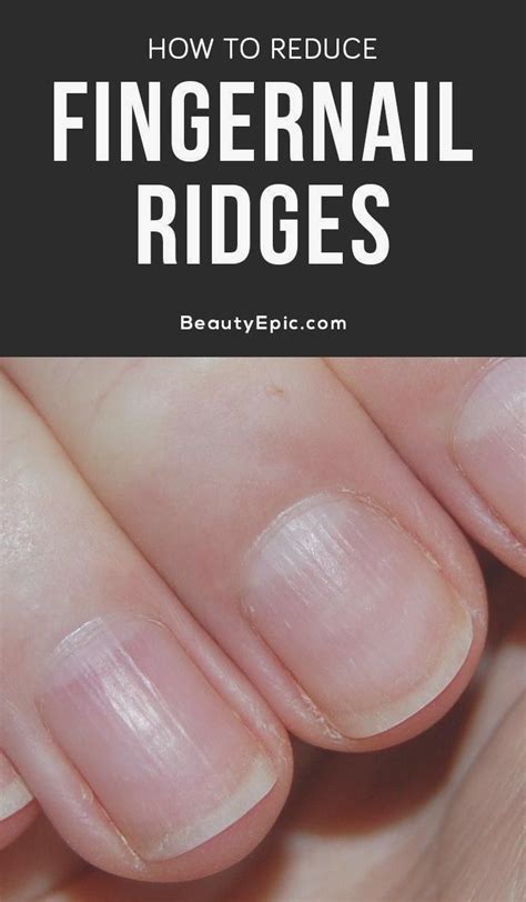 What Do Ridges Across Your Nails Mean Design Talk
