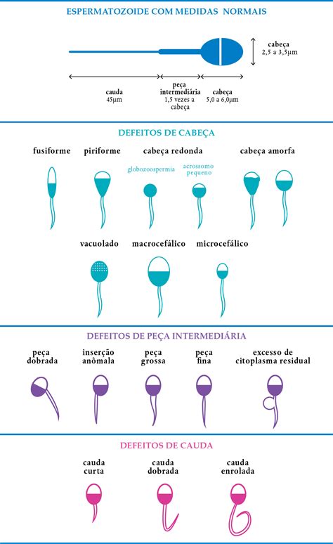 Espermograma Motilidade Progressiva Lenta