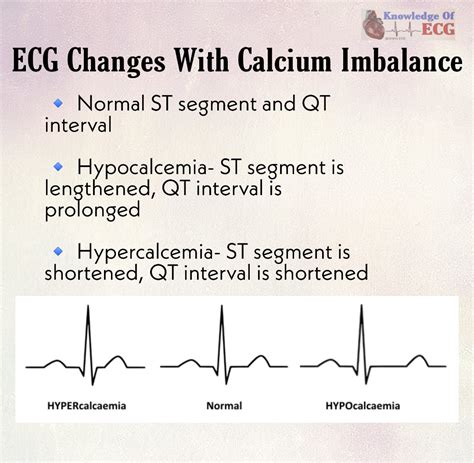 Ecg Changes In Hypocalcemia