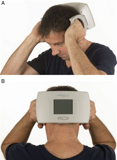 Neurostimulation In The Treatment Of Primary Headaches Practical