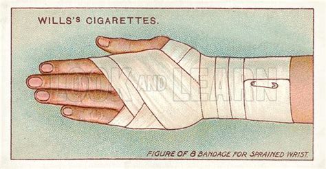 First Aid Figure Of 8 Bandage For Sprained Wrist Stock Image Look