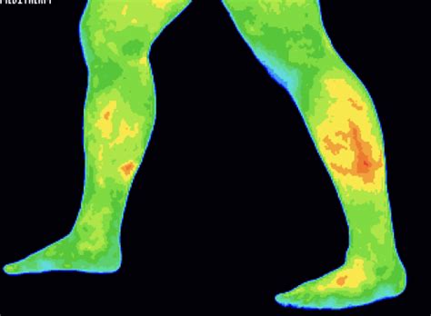 Thermography — Upper Cervical Chiropractic Of Tulsa